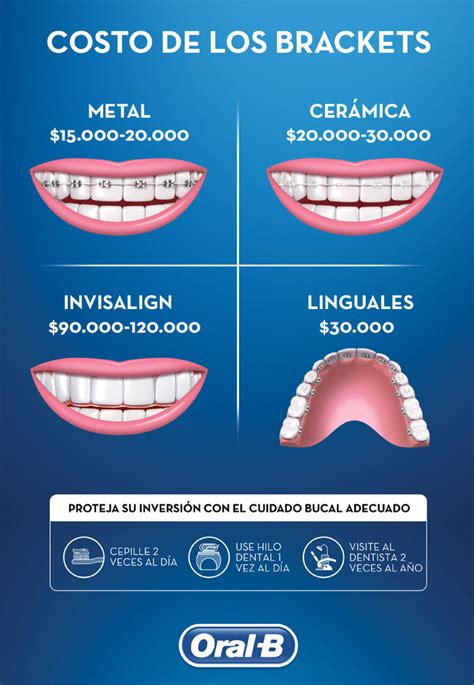 cuanto cuesta un bracket